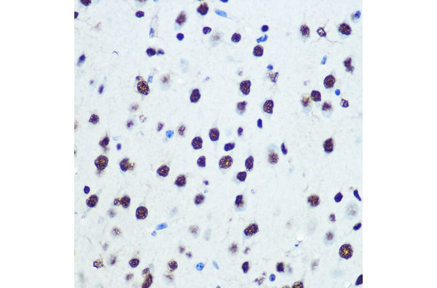 Immunohistochemistry - Anti-hnRNP K Antibody [ARC0512] (A307298) - Antibodies.com