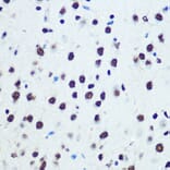 Immunohistochemistry - Anti-hnRNP K Antibody [ARC0512] (A307298) - Antibodies.com