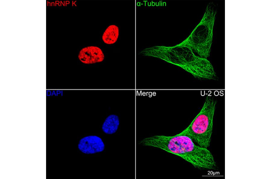 Immunofluorescence - Anti-hnRNP K Antibody [ARC0512] (A307298) - Antibodies.com