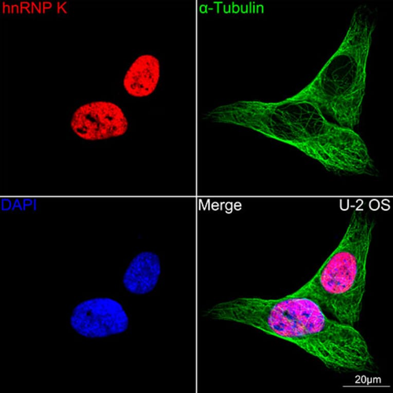 Immunofluorescence - Anti-hnRNP K Antibody [ARC0512] (A307298) - Antibodies.com