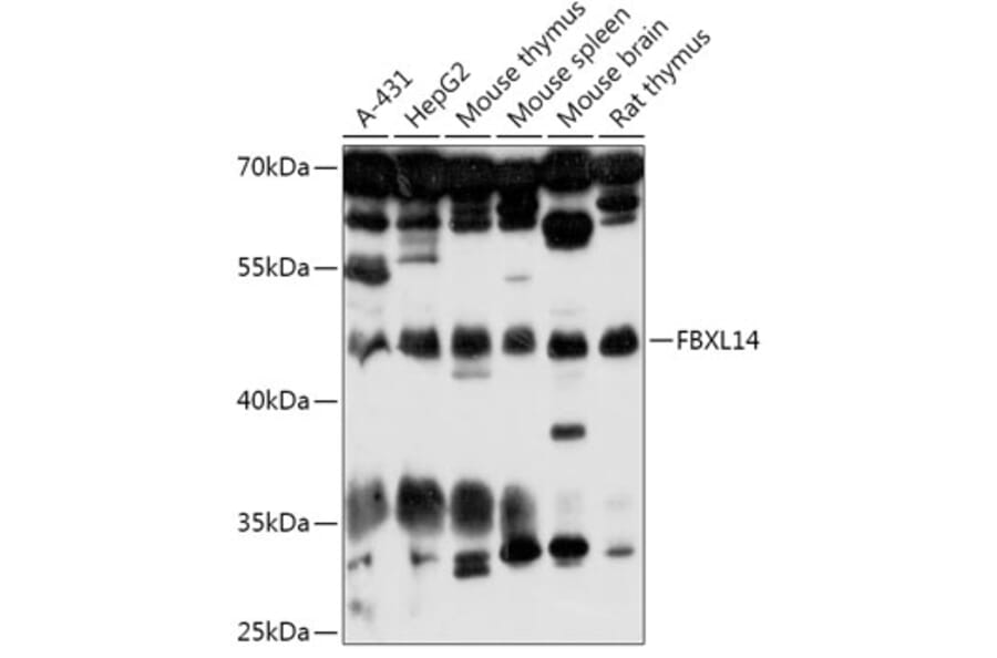 Western Blot - Anti-FBXL14 Antibody (A307299) - Antibodies.com