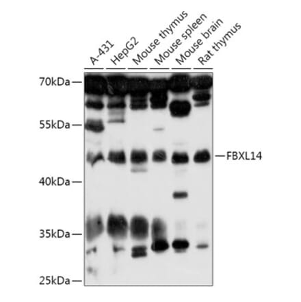 Western Blot - Anti-FBXL14 Antibody (A307299) - Antibodies.com