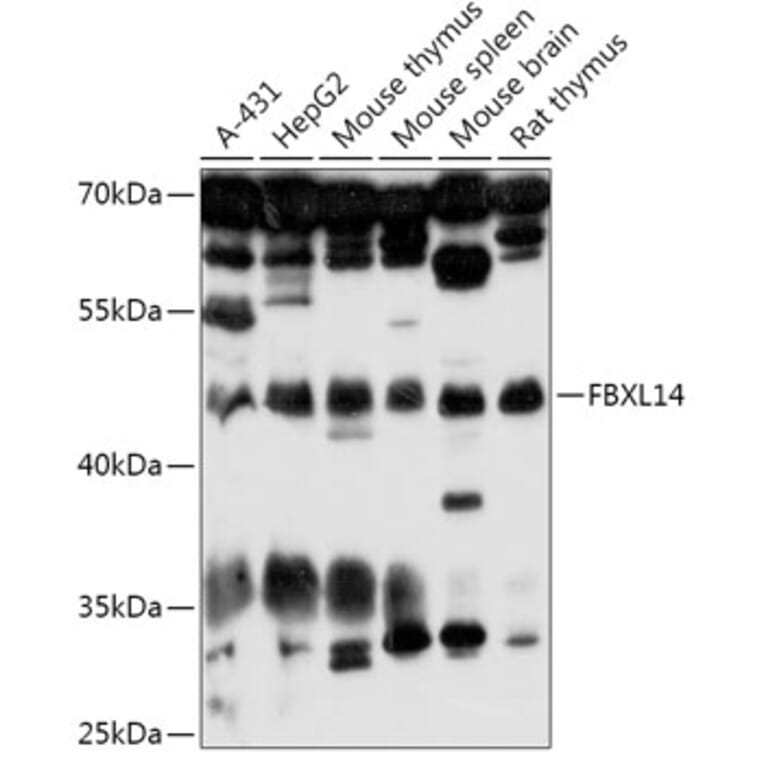 Western Blot - Anti-FBXL14 Antibody (A307299) - Antibodies.com