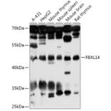Western Blot - Anti-FBXL14 Antibody (A307299) - Antibodies.com