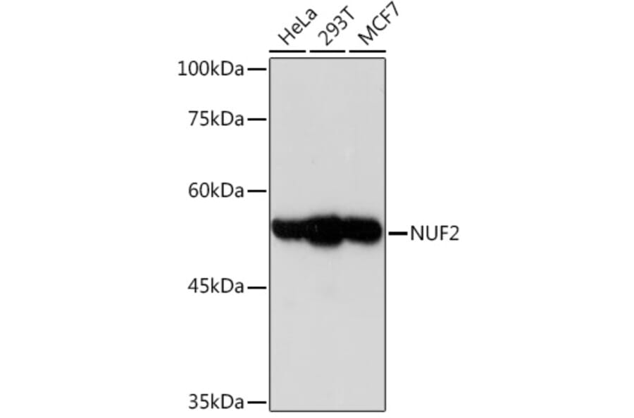 Western Blot - Anti-Nuf2 Antibody [ARC2157] (A307301) - Antibodies.com