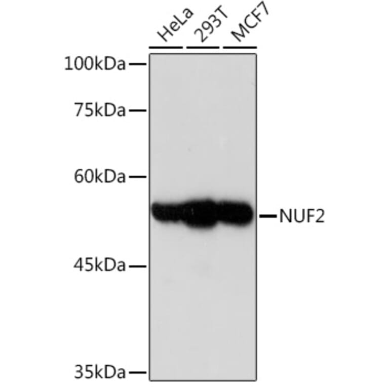 Western Blot - Anti-Nuf2 Antibody [ARC2157] (A307301) - Antibodies.com