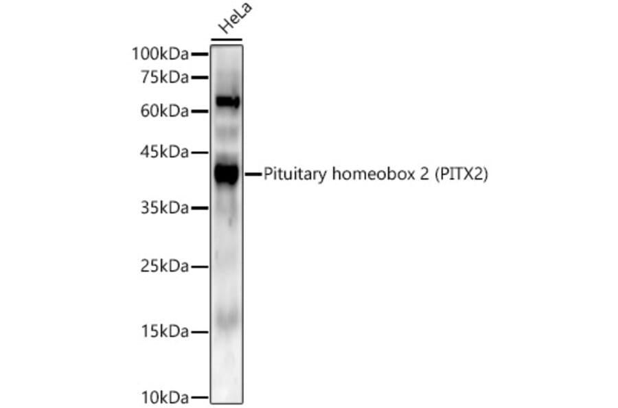 Western Blot - Anti-PITX2/RGS Antibody [ARC56103] (A307302) - Antibodies.com