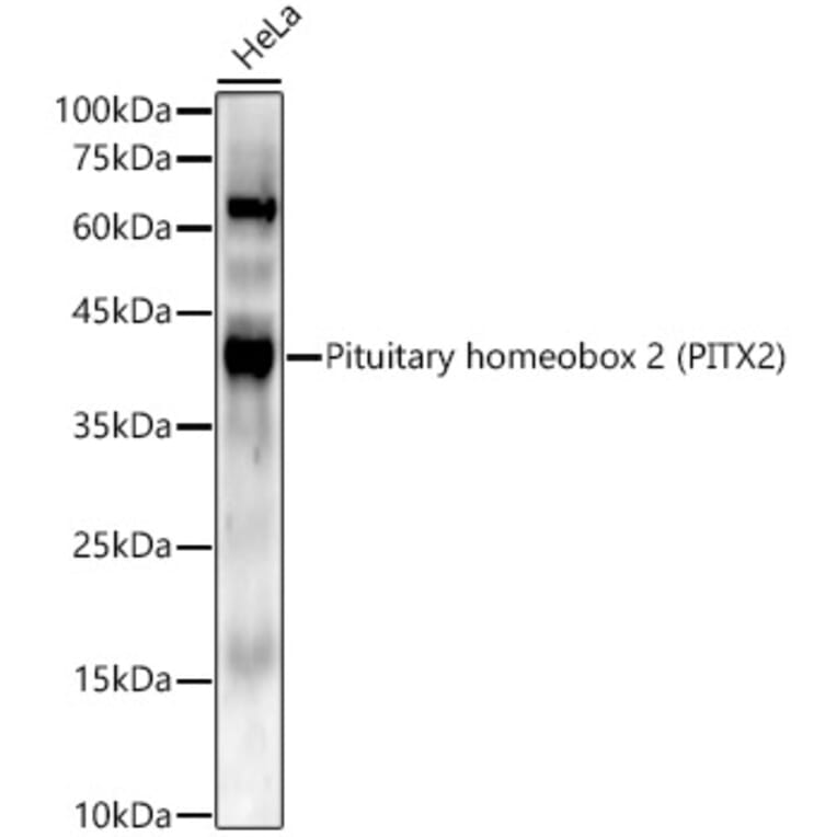 Western Blot - Anti-PITX2/RGS Antibody [ARC56103] (A307302) - Antibodies.com