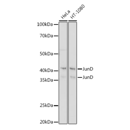 Western Blot - Anti-JunD Antibody [ARC1409] (A307304) - Antibodies.com