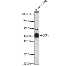 Western Blot - Anti-CCR1 Antibody (A307305) - Antibodies.com