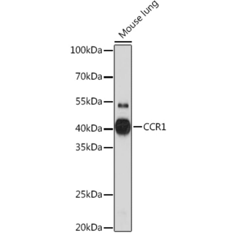 Western Blot - Anti-CCR1 Antibody (A307305) - Antibodies.com