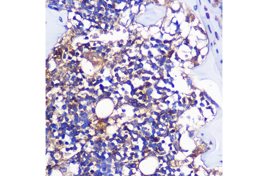 Immunohistochemistry - Anti-CCR1 Antibody (A307305) - Antibodies.com