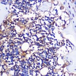 Immunohistochemistry - Anti-CCR1 Antibody (A307305) - Antibodies.com