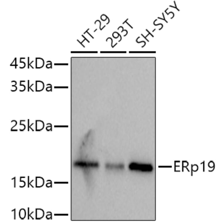 Western Blot - Anti-ERp18 Antibody [ARC2718] (A307306) - Antibodies.com