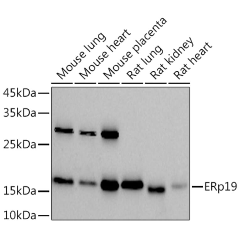 Western Blot - Anti-ERp18 Antibody [ARC2718] (A307306) - Antibodies.com