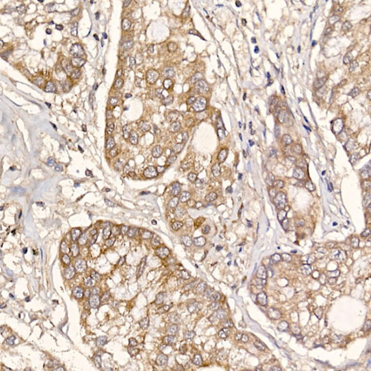 Immunohistochemistry - Anti-ERp18 Antibody [ARC2718] (A307306) - Antibodies.com