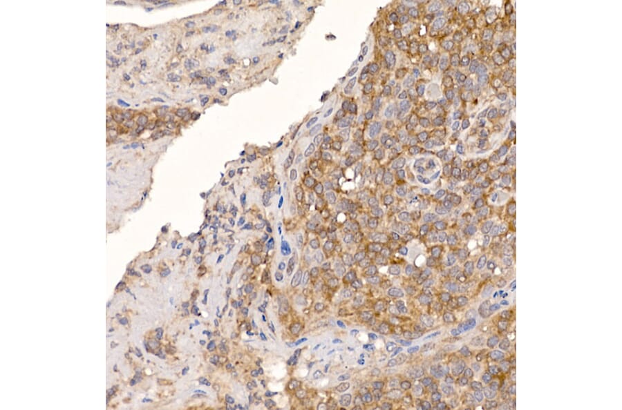 Immunohistochemistry - Anti-ERp18 Antibody [ARC2718] (A307306) - Antibodies.com