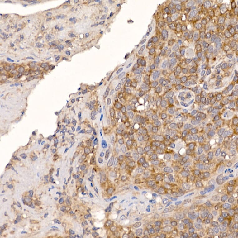 Immunohistochemistry - Anti-ERp18 Antibody [ARC2718] (A307306) - Antibodies.com