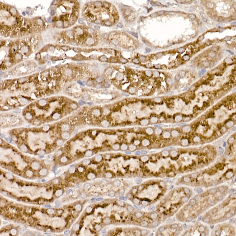 Immunohistochemistry - Anti-ERp18 Antibody [ARC2718] (A307306) - Antibodies.com