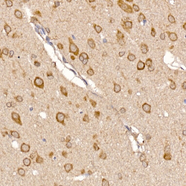 Immunohistochemistry - Anti-ERp18 Antibody [ARC2718] (A307306) - Antibodies.com