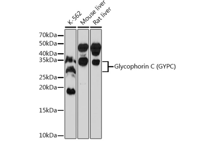 Western Blot - Anti-Glycophorin C/GPC Antibody [ARC0605] (A307307) - Antibodies.com