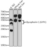 Western Blot - Anti-Glycophorin C/GPC Antibody [ARC0605] (A307307) - Antibodies.com