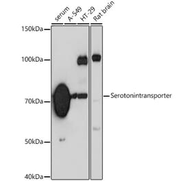 Western Blot - Anti-Serotonin transporter Antibody [ARC0441] (A307308) - Antibodies.com