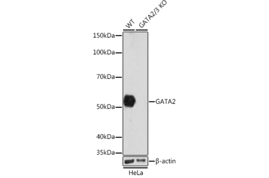 Western Blot - Anti-GATA2 + GATA3 Antibody [ARC1209] (A307309) - Antibodies.com