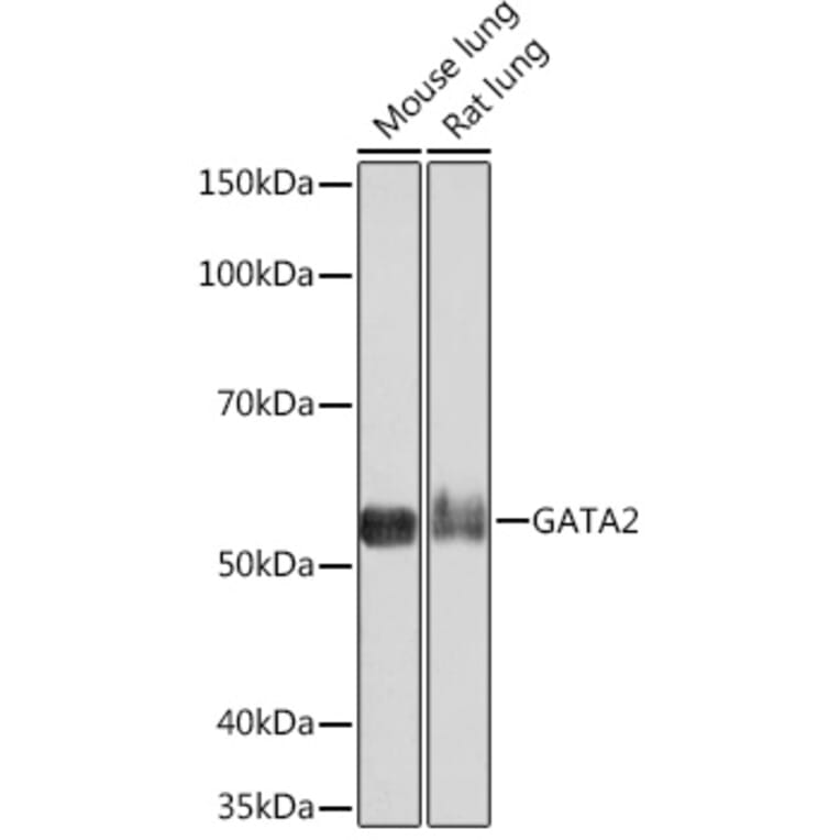 Western Blot - Anti-GATA2 + GATA3 Antibody [ARC1209] (A307309) - Antibodies.com