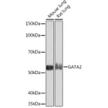 Western Blot - Anti-GATA2 + GATA3 Antibody [ARC1209] (A307309) - Antibodies.com
