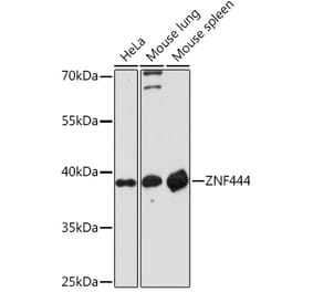 Western Blot - Anti-ZNF444 Antibody (A307310) - Antibodies.com