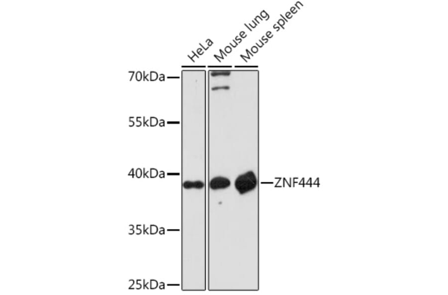 Western Blot - Anti-ZNF444 Antibody (A307310) - Antibodies.com