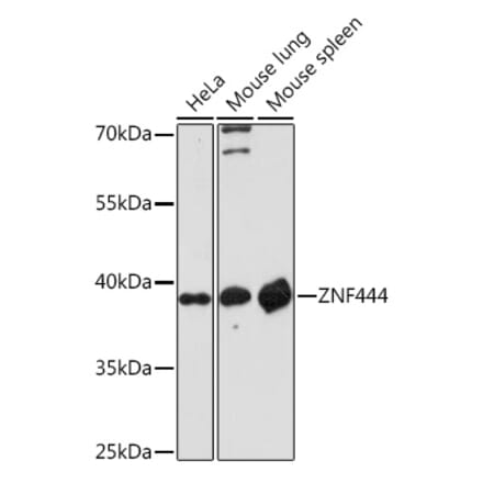 Western Blot - Anti-ZNF444 Antibody (A307310) - Antibodies.com