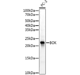 Western Blot - Anti-Bok Antibody [ARC53171] (A307311) - Antibodies.com