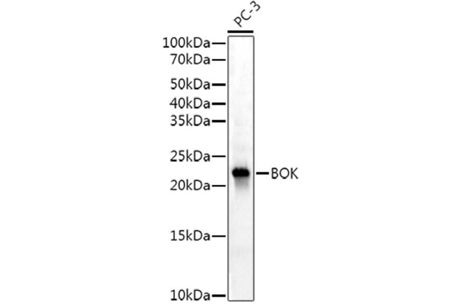 Western Blot - Anti-Bok Antibody [ARC53171] (A307311) - Antibodies.com