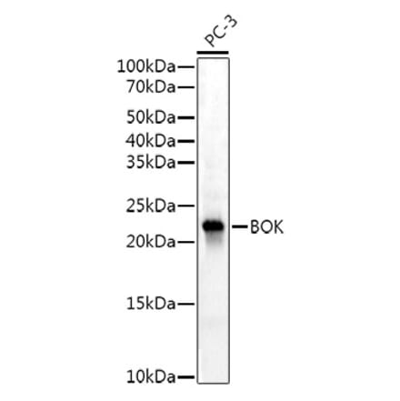 Western Blot - Anti-Bok Antibody [ARC53171] (A307311) - Antibodies.com