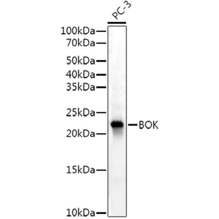 Western Blot - Anti-Bok Antibody [ARC53171] (A307311) - Antibodies.com