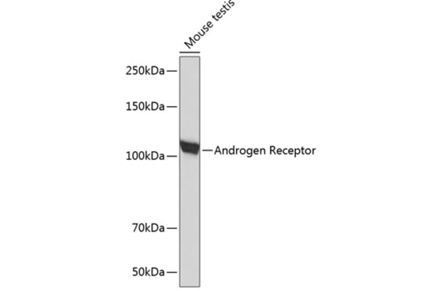 Western Blot - Anti-Androgen Receptor Antibody [ARC0090] (A307312) - Antibodies.com