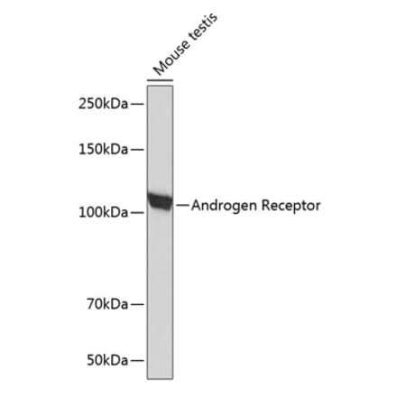 Western Blot - Anti-Androgen Receptor Antibody [ARC0090] (A307312) - Antibodies.com