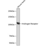 Western Blot - Anti-Androgen Receptor Antibody [ARC0090] (A307312) - Antibodies.com