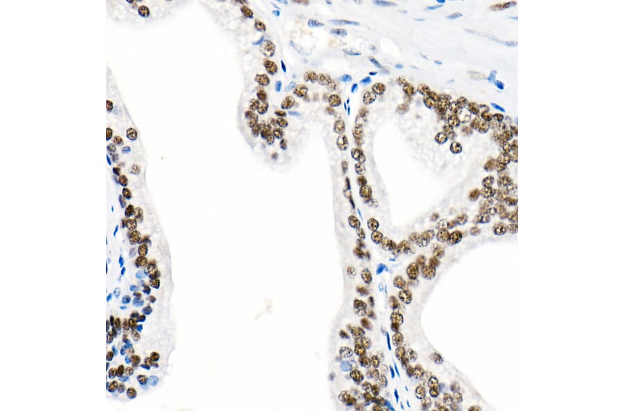 Immunohistochemistry - Anti-Androgen Receptor Antibody [ARC0090] (A307312) - Antibodies.com