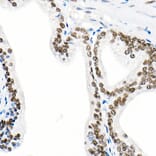 Immunohistochemistry - Anti-Androgen Receptor Antibody [ARC0090] (A307312) - Antibodies.com