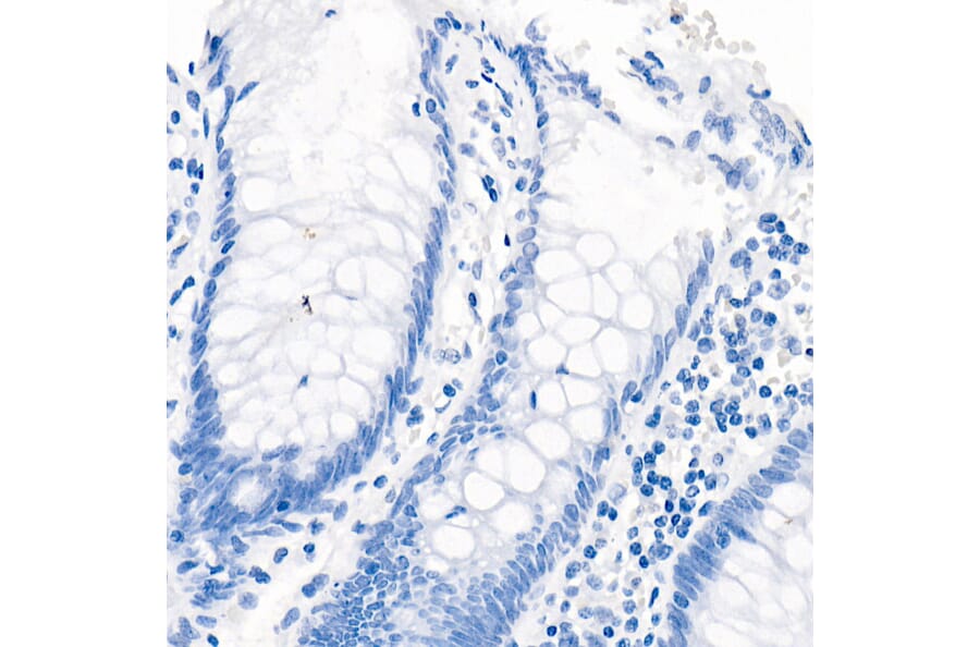 Immunohistochemistry - Anti-Androgen Receptor Antibody [ARC0090] (A307312) - Antibodies.com