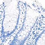 Immunohistochemistry - Anti-Androgen Receptor Antibody [ARC0090] (A307312) - Antibodies.com