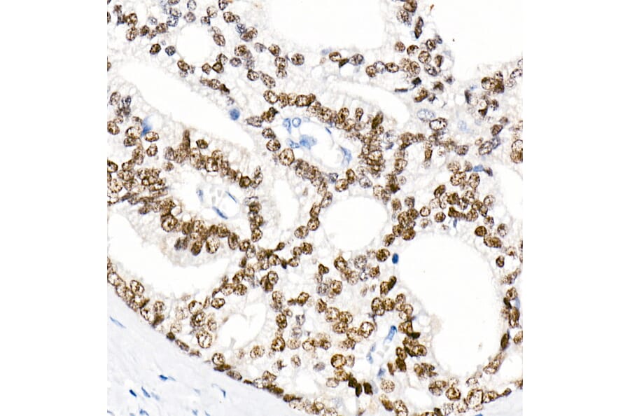 Immunohistochemistry - Anti-Androgen Receptor Antibody [ARC0090] (A307312) - Antibodies.com