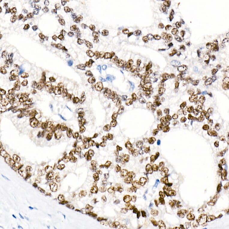 Immunohistochemistry - Anti-Androgen Receptor Antibody [ARC0090] (A307312) - Antibodies.com