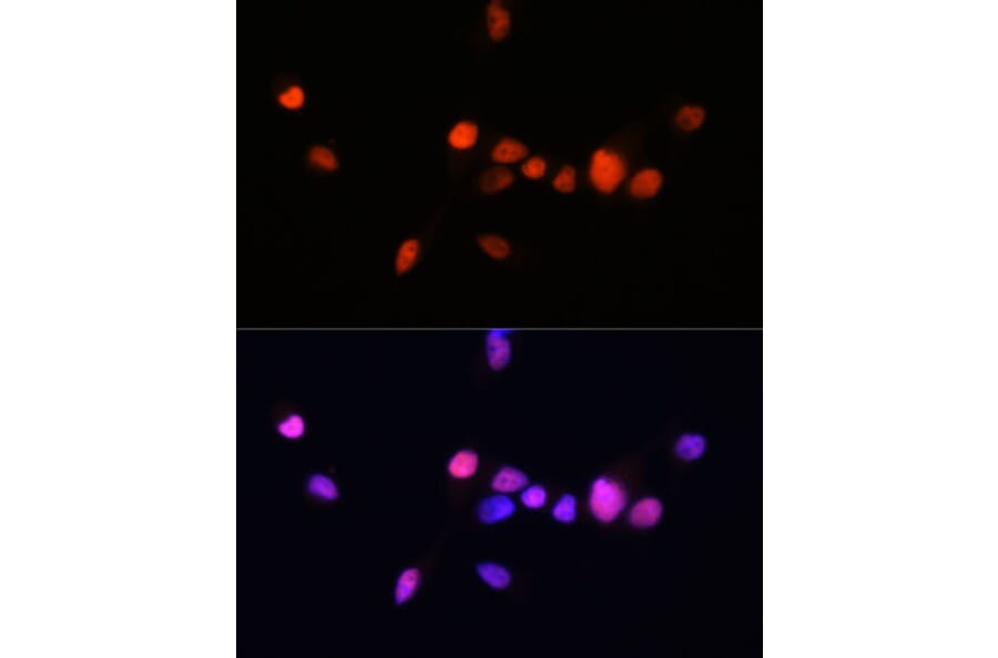 Immunofluorescence - Anti-Androgen Receptor Antibody [ARC0090] (A307312) - Antibodies.com