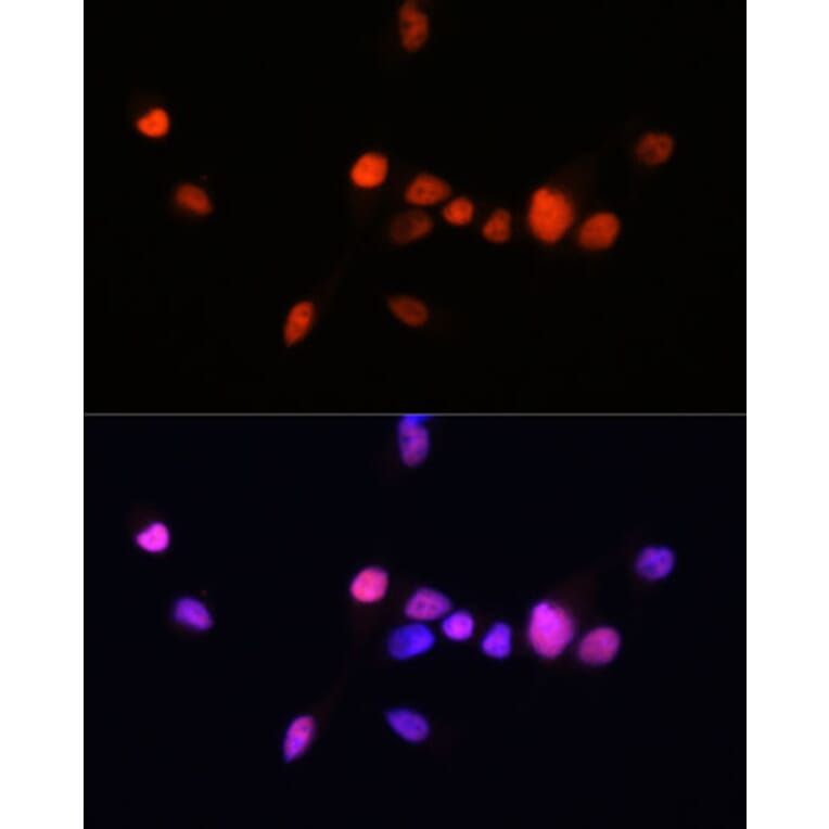 Immunofluorescence - Anti-Androgen Receptor Antibody [ARC0090] (A307312) - Antibodies.com