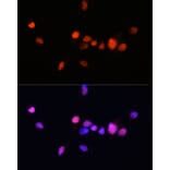 Immunofluorescence - Anti-Androgen Receptor Antibody [ARC0090] (A307312) - Antibodies.com