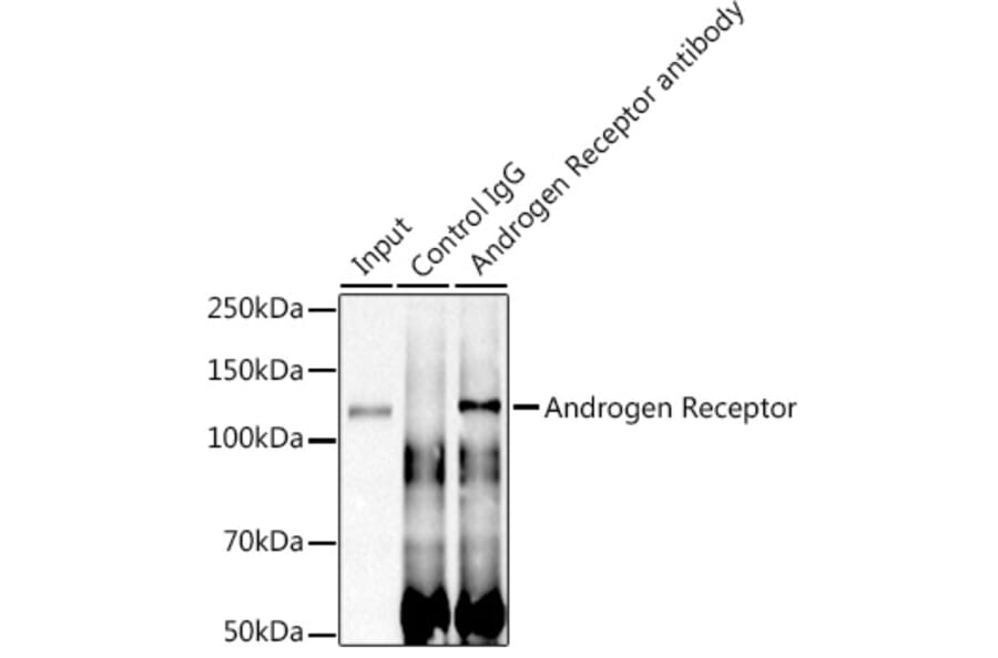 Western Blot - Anti-Androgen Receptor Antibody [ARC0090] (A307312) - Antibodies.com